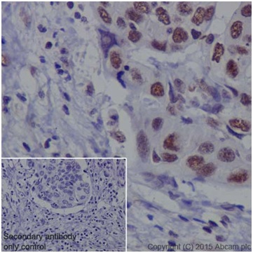 Immunohistochemistry (Formalin/PFA-fixed paraffin-embedded sections) - Anti-METTL3 antibody [EPR18810] (ab195352), expandable thumbnail