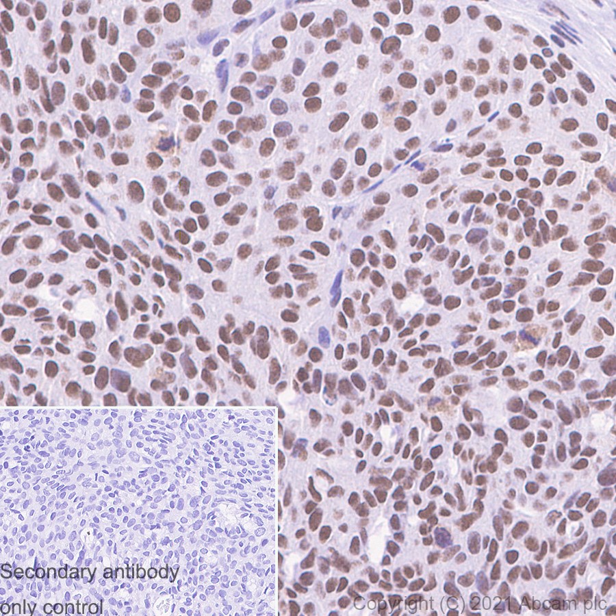 Immunohistochemistry (Formalin/PFA-fixed paraffin-embedded sections) - Anti-METTL3 antibody [EPR18810] (ab195352), expandable thumbnail