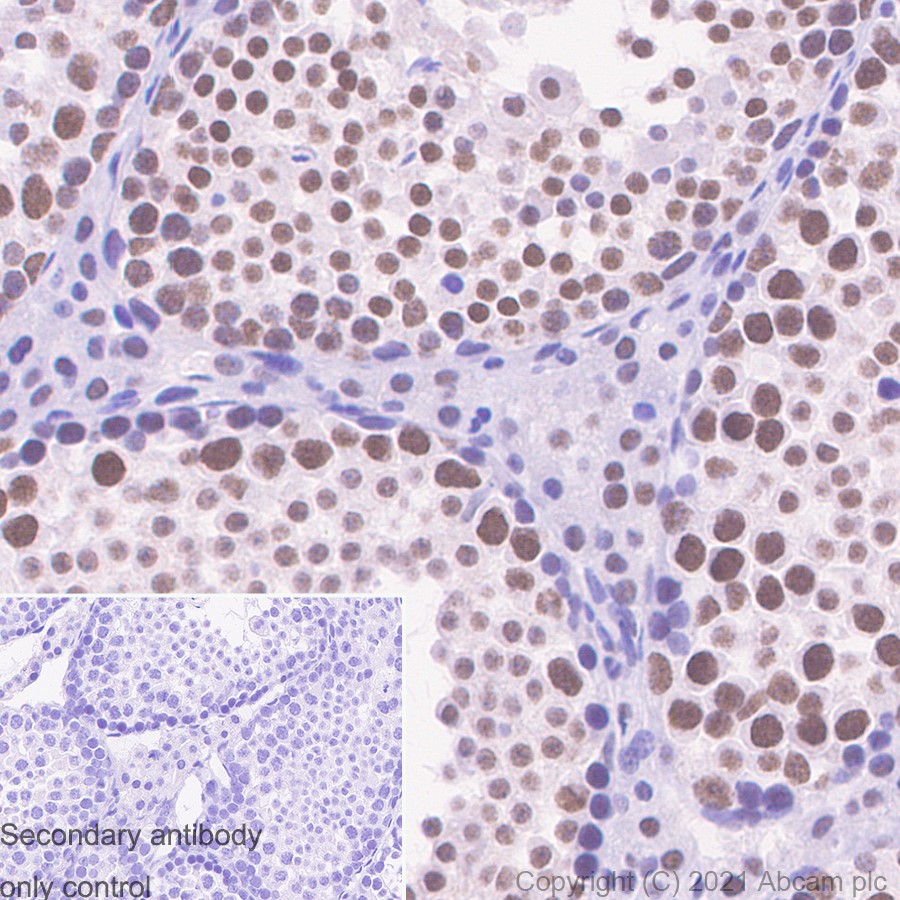 Immunohistochemistry (Formalin/PFA-fixed paraffin-embedded sections) - Anti-METTL3 antibody [EPR18810] (ab195352), expandable thumbnail