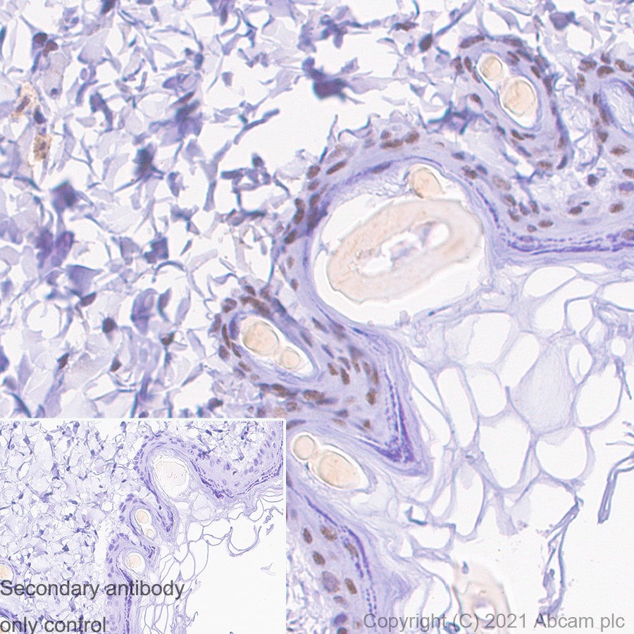 Immunohistochemistry (Formalin/PFA-fixed paraffin-embedded sections) - Anti-METTL3 antibody [EPR18810] (AB195352), expandable thumbnail