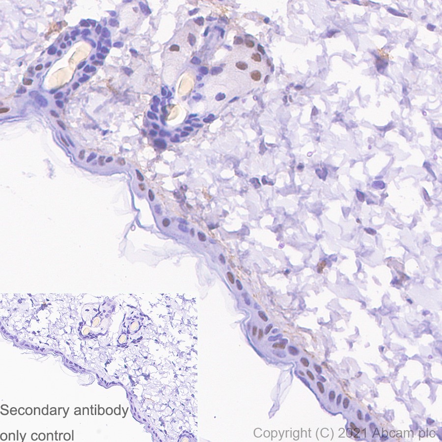 Immunohistochemistry (Formalin/PFA-fixed paraffin-embedded sections) - Anti-METTL3 antibody [EPR18810] (ab195352), expandable thumbnail