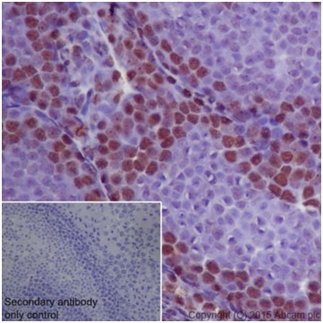 Immunohistochemistry (Formalin/PFA-fixed paraffin-embedded sections) - Anti-METTL3 antibody [EPR18810] (ab195352), expandable thumbnail