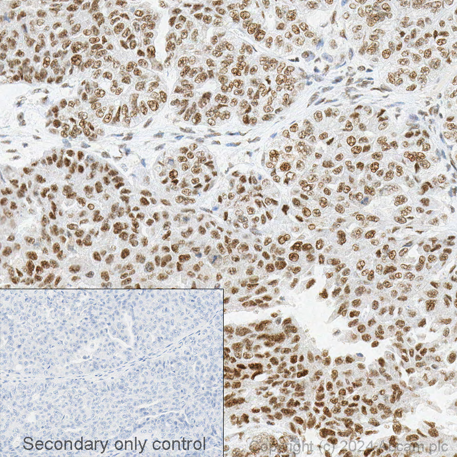 Immunohistochemistry - Anti-METTL3 antibody [EPR18810] (AB195352), expandable thumbnail