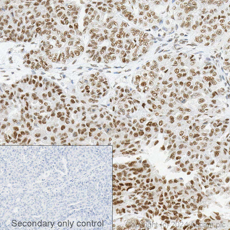 Immunohistochemistry - Anti-METTL3 antibody [EPR18810] (AB195352)