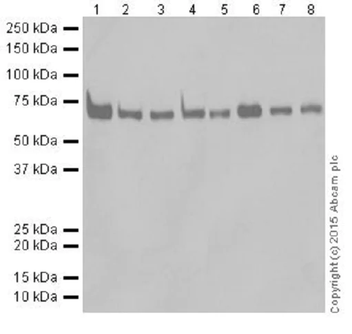 Western blot - Anti-METTL3 antibody [EPR18810] (AB195352)