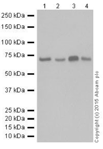 Western blot - Anti-METTL3 antibody [EPR18810] (ab195352), expandable thumbnail