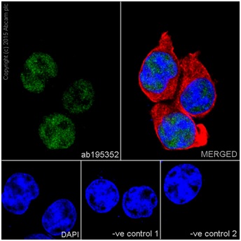 Immunocytochemistry/ Immunofluorescence - Anti-METTL3 antibody [EPR18810] - BSA and Azide free (AB221795)