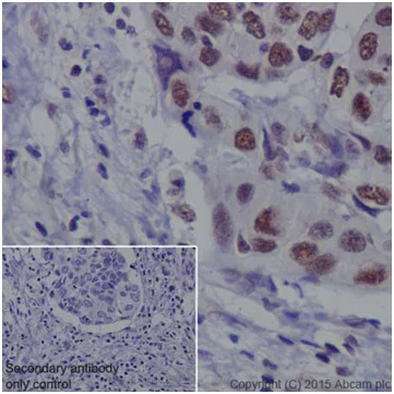 Immunohistochemistry (Formalin/PFA-fixed paraffin-embedded sections) - Anti-METTL3 antibody [EPR18810] - BSA and Azide free (AB221795)
