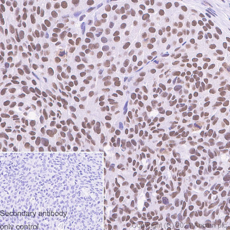Immunohistochemistry (Formalin/PFA-fixed paraffin-embedded sections) - Anti-METTL3 antibody [EPR18810] - BSA and Azide free (AB221795)