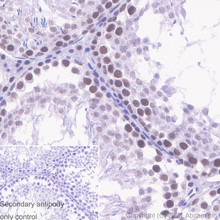 Immunohistochemistry (Formalin/PFA-fixed paraffin-embedded sections) - Anti-METTL3 antibody [EPR18810] - BSA and Azide free (AB221795)