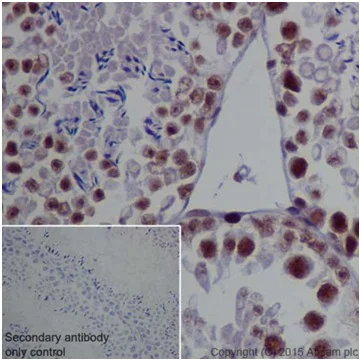Immunohistochemistry (Formalin/PFA-fixed paraffin-embedded sections) - Anti-METTL3 antibody [EPR18810] - BSA and Azide free (AB221795)