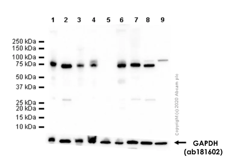 Western blot - Anti-METTL3 antibody [EPR18810] - BSA and Azide free (AB221795)