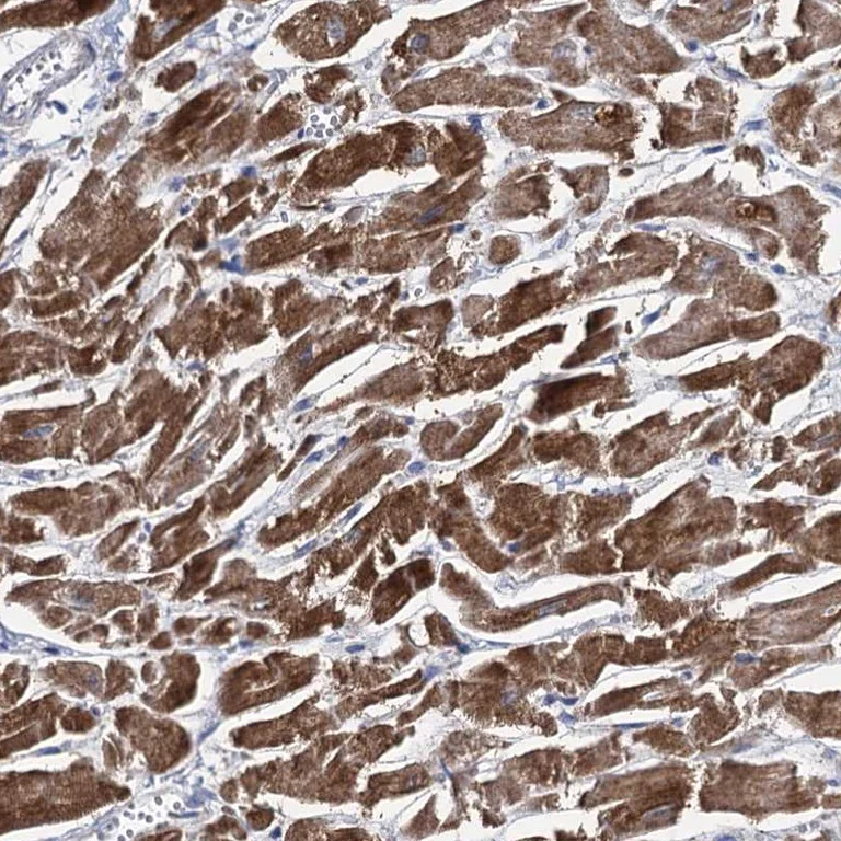 Immunohistochemistry (Formalin/PFA-fixed paraffin-embedded sections) - Anti-METTL4 antibody (AB261735)