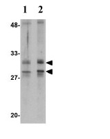 Western blot - Anti-METTL7A antibody (AB79207)