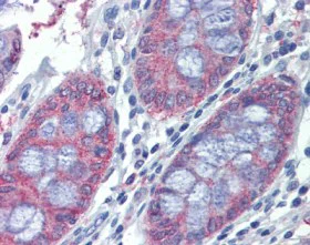 Immunohistochemistry (Formalin/PFA-fixed paraffin-embedded sections) - Anti-METTL7B antibody (AB110134)