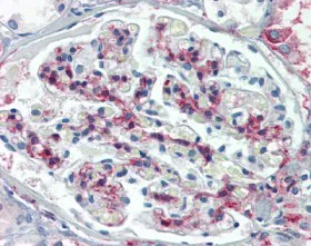 Immunohistochemistry (Formalin/PFA-fixed paraffin-embedded sections) - Anti-METTL7B antibody (AB110134)