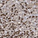 Immunohistochemistry (Formalin/PFA-fixed paraffin-embedded sections) - Anti-METTL8 antibody (AB122273)