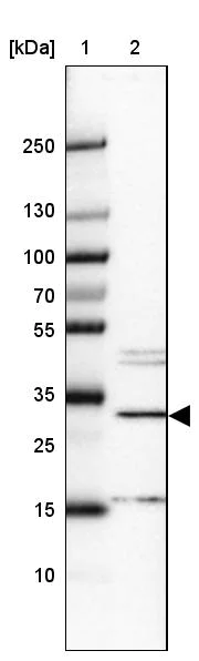 Western blot - Anti-METTL8 antibody (AB122273)