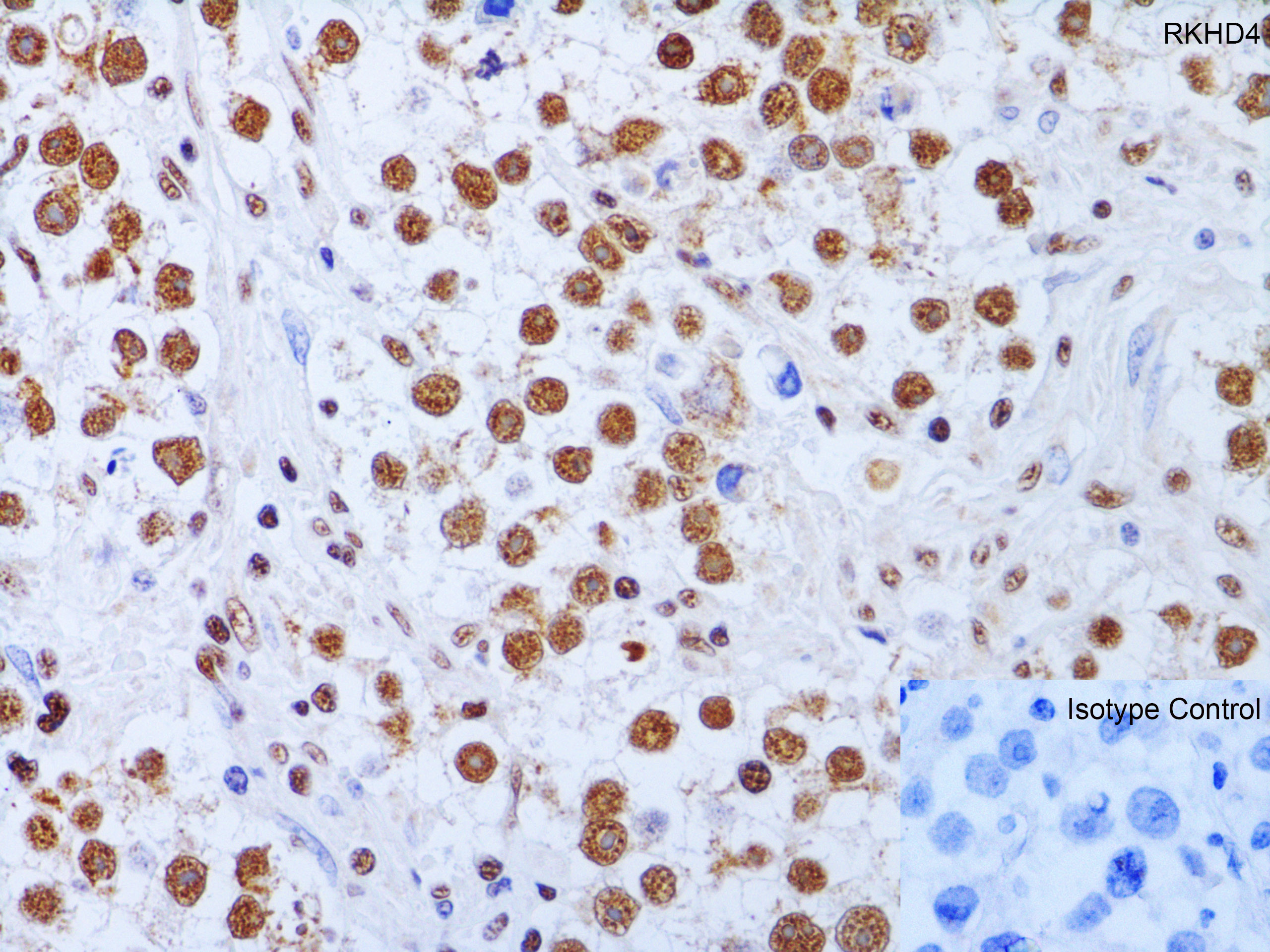 Immunohistochemistry (Formalin/PFA-fixed paraffin-embedded sections) - Anti-MEX3A antibody (AB79046)