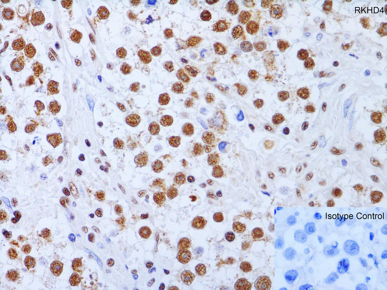 Immunohistochemistry (Formalin/PFA-fixed paraffin-embedded sections) - Anti-MEX3A antibody (AB79046)