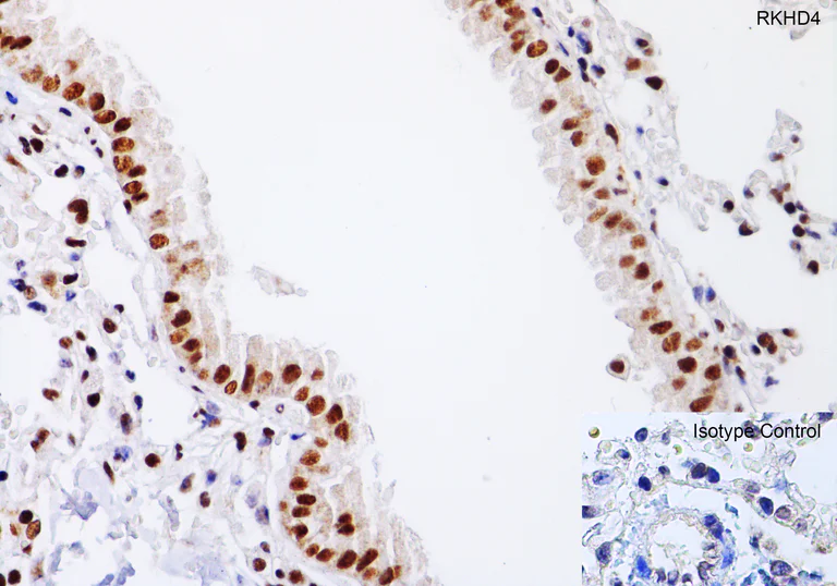 Immunohistochemistry (Formalin/PFA-fixed paraffin-embedded sections) - Anti-MEX3A antibody (AB79046)