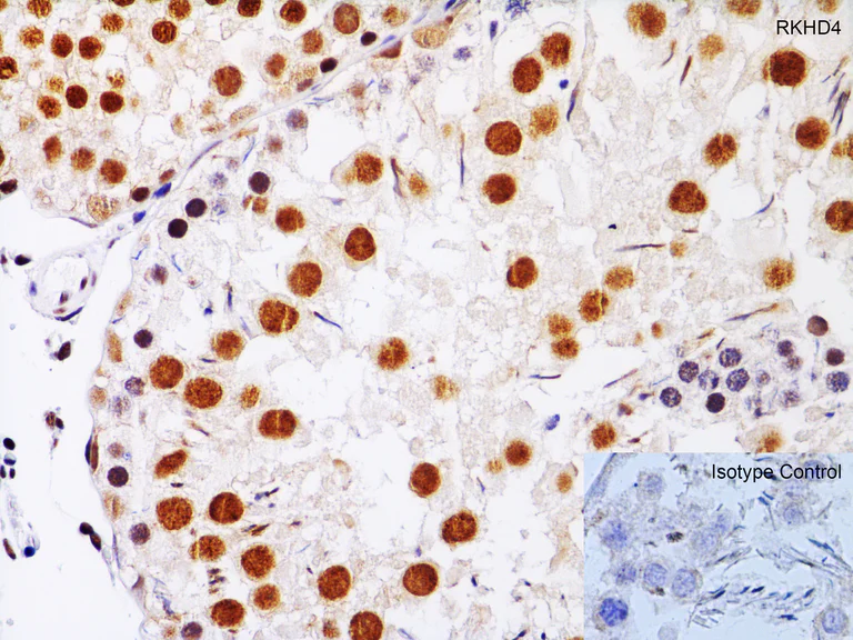 Immunohistochemistry (Formalin/PFA-fixed paraffin-embedded sections) - Anti-MEX3A antibody (AB79046)