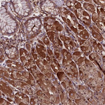 Immunohistochemistry (Formalin/PFA-fixed paraffin-embedded sections) - Anti-MEX3C antibody (AB243457)