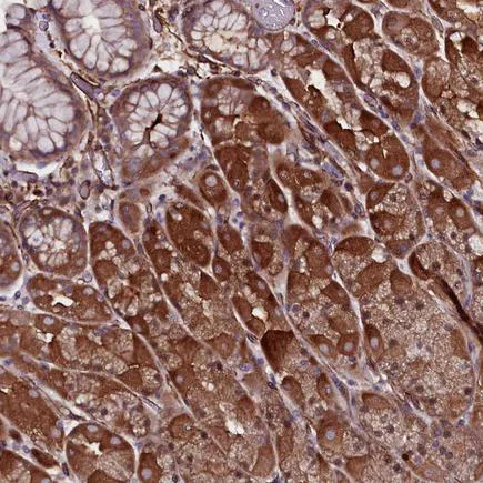 Immunohistochemistry (Formalin/PFA-fixed paraffin-embedded sections) - Anti-MEX3C antibody (AB243457)