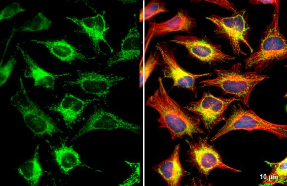 Immunocytochemistry/ Immunofluorescence - Anti-MFF antibody [HL1312] - BSA and Azide free (AB327550)