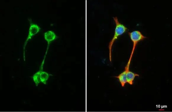 Immunocytochemistry/ Immunofluorescence - Anti-MFF antibody [HL1312] - BSA and Azide free (AB327550)