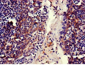 Immunohistochemistry (Formalin/PFA-fixed paraffin-embedded sections) - Anti-MFI2/MTf antibody (AB236732)