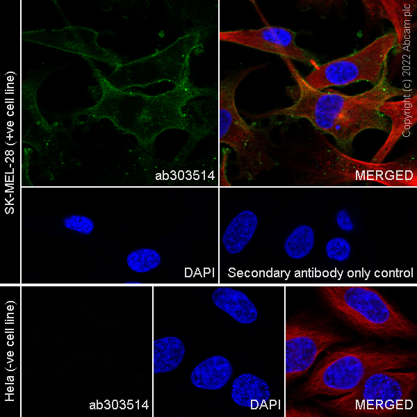 Immunocytochemistry/ Immunofluorescence - Anti-MFI2/MTf antibody [EPR27232-23] (AB303514)
