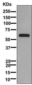 Western blot - Anti-MFRP antibody [EPR11616] - BSA and Azide free (AB249929)