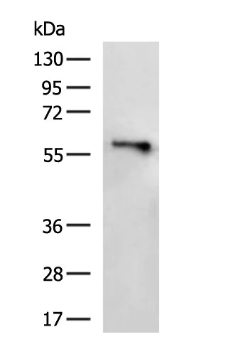 Western blot - Anti-MFSD2A/NLS1 Antibody (AB316949)