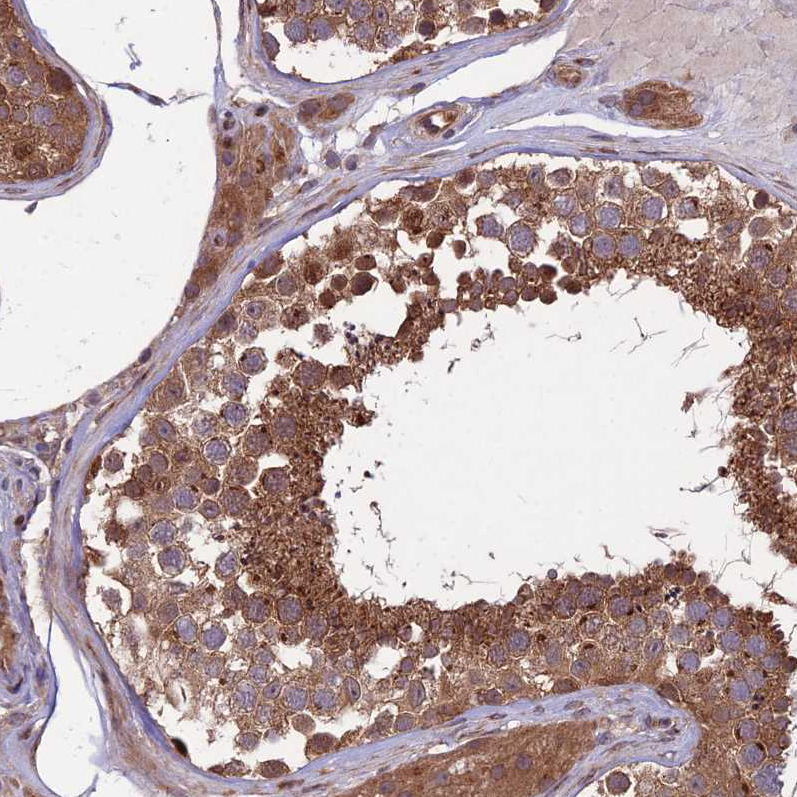 Immunohistochemistry (Formalin/PFA-fixed paraffin-embedded sections) - Anti-MFSD8 antibody (AB254816), expandable thumbnail