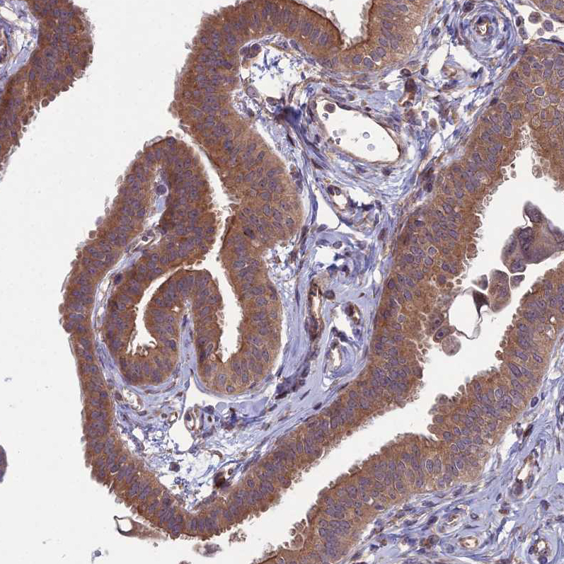 Immunohistochemistry (Formalin/PFA-fixed paraffin-embedded sections) - Anti-MFSD8 antibody (AB254816), expandable thumbnail