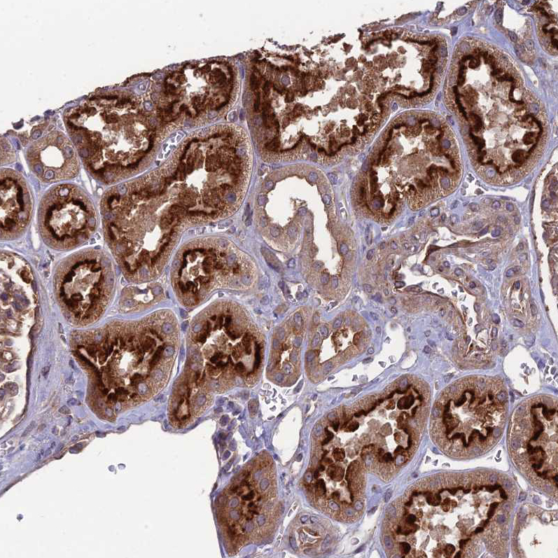 Immunohistochemistry (Formalin/PFA-fixed paraffin-embedded sections) - Anti-MFSD8 antibody (AB254816), expandable thumbnail