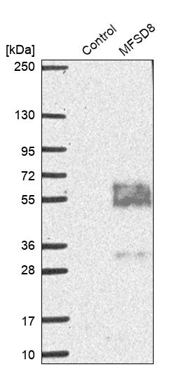 Western blot - Anti-MFSD8 antibody (AB254816), expandable thumbnail