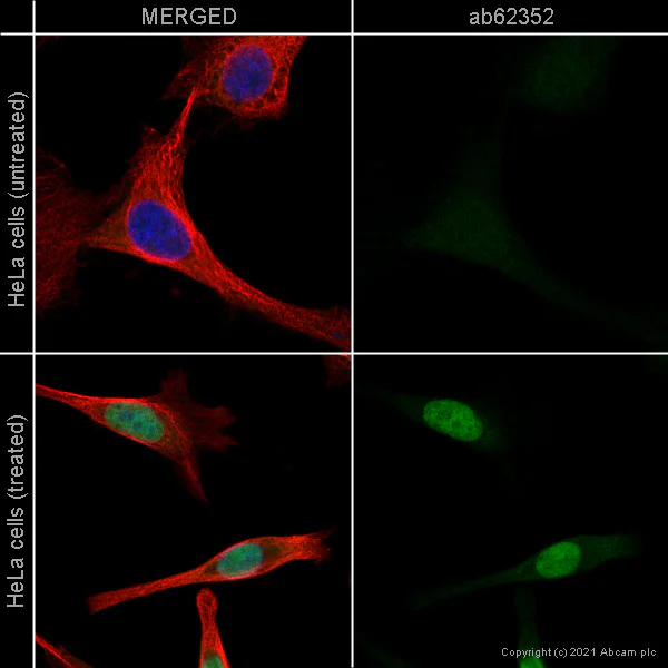Immunocytochemistry/ Immunofluorescence - MG-132, proteasome inhibitor (AB141003)