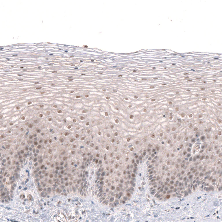 Immunohistochemistry (Formalin/PFA-fixed paraffin-embedded sections) - Anti-MGA antibody (AB254622)