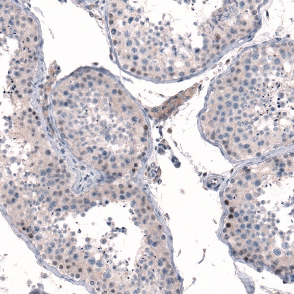 Immunohistochemistry (Formalin/PFA-fixed paraffin-embedded sections) - Anti-MGA antibody (AB254622)