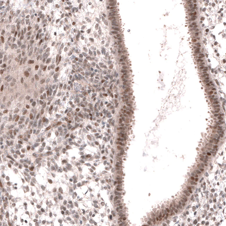 Immunohistochemistry (Formalin/PFA-fixed paraffin-embedded sections) - Anti-MGA antibody (AB254622)