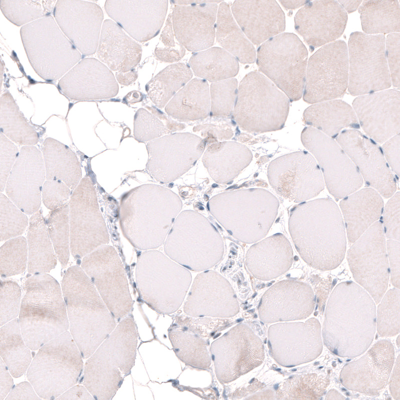 Immunohistochemistry (Formalin/PFA-fixed paraffin-embedded sections) - Anti-MGA antibody (AB254622)