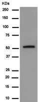 Western blot - Anti-MGAT1 antibody [EPR14247] (AB180578), expandable thumbnail
