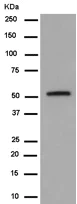 Western blot - Anti-MGAT1 antibody [EPR14247] (AB180578)