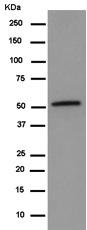 Western blot - Anti-MGAT1 antibody [EPR14247] (AB180578), expandable thumbnail