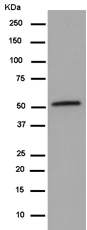 Western blot - Anti-MGAT1 antibody [EPR14247] (AB180578)