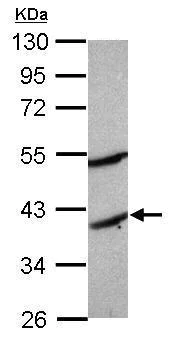 Western blot - Anti-MGAT2 antibody (AB228950)