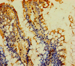 Immunohistochemistry (Formalin/PFA-fixed paraffin-embedded sections) - Anti-MGAT2 antibody (AB238762)