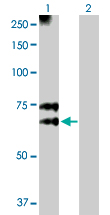 Western blot - Anti-MGAT3 antibody (AB103427)